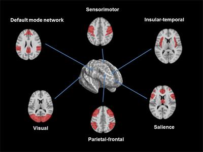 Structural and Functional Brain Patterns of Non-Motor Syndromes in Parkinson’s Disease